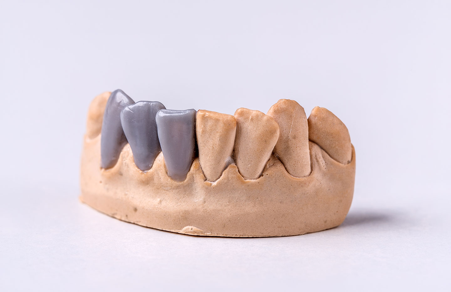 Material CAD/CAM Cera para fresagem