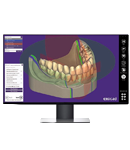 CAD/CAM Exocad