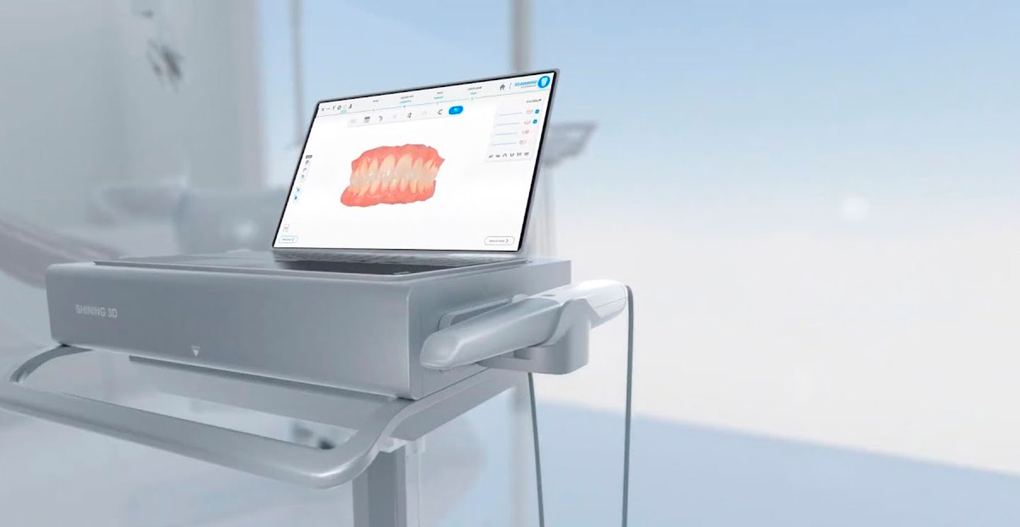 Shining 3D - Scanner Intraoral para dentistas