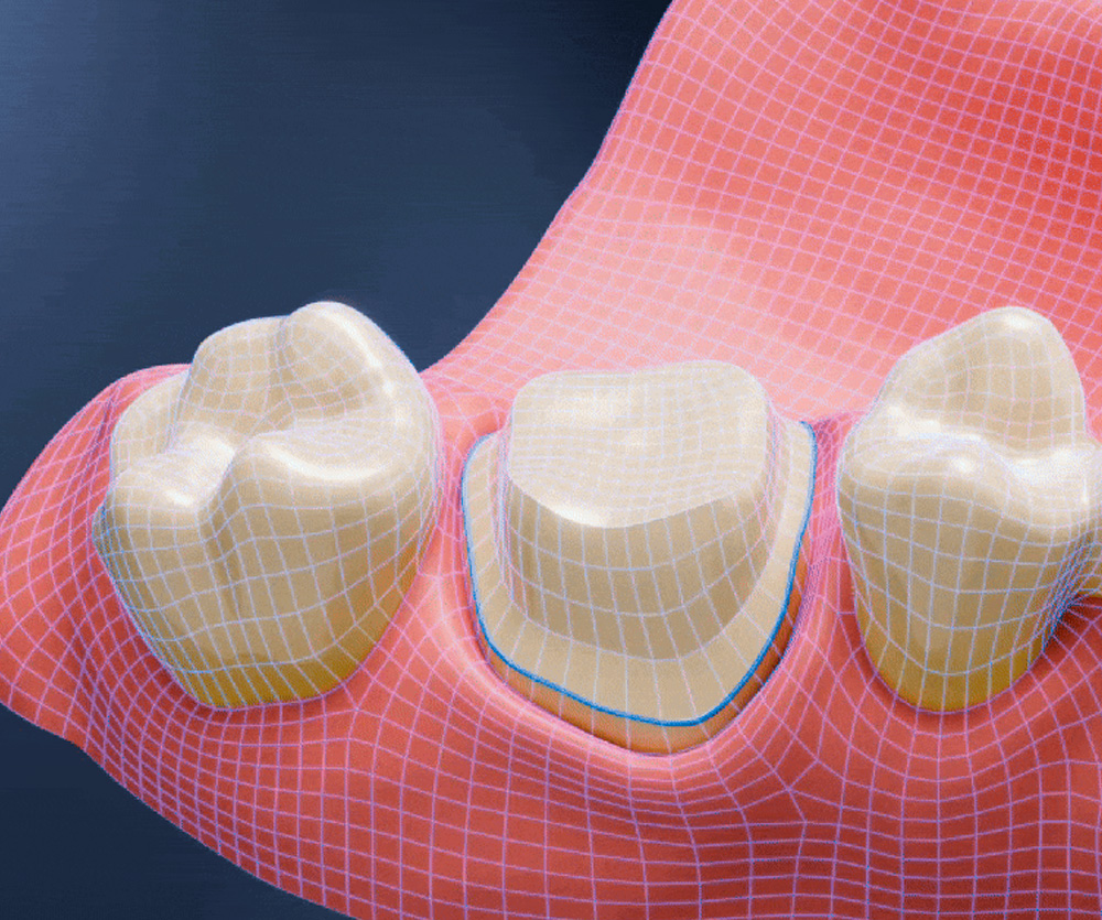 faq-aoralscan-elf
