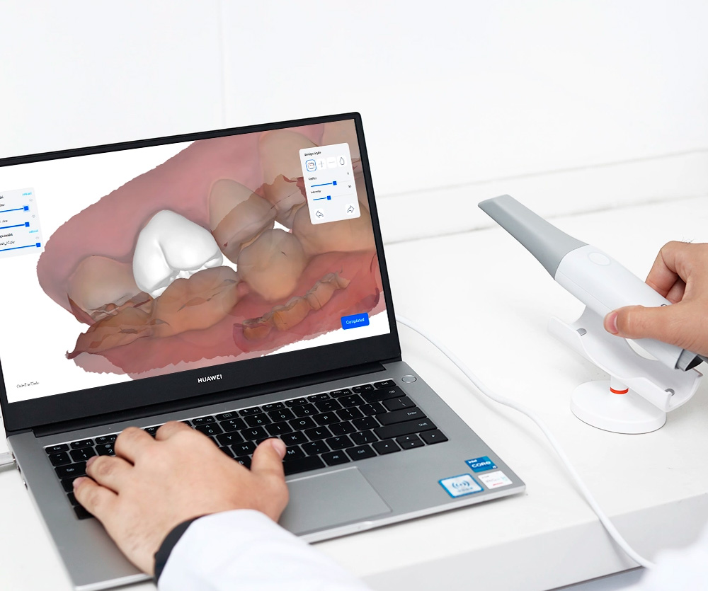UP3D UP610 intraoral scanner