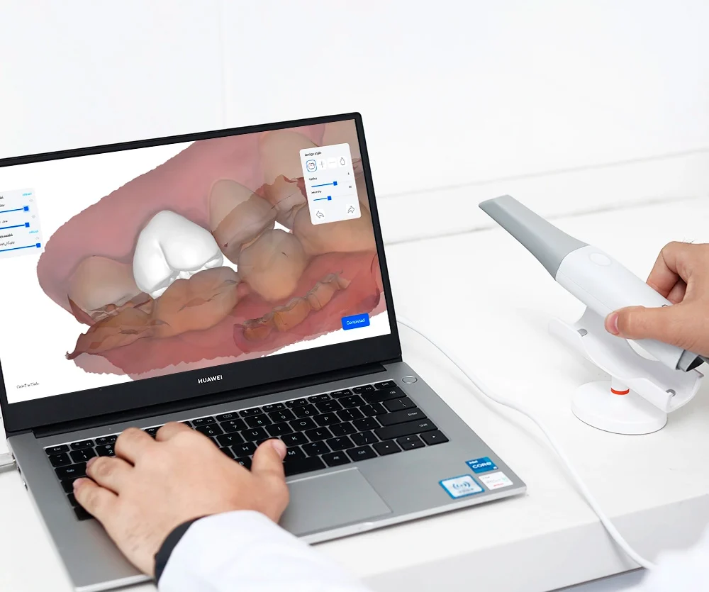 UP3D UP610 intraoral scanner