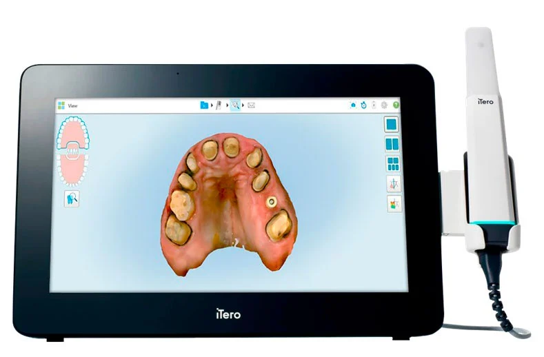 Intraoral Scanner - iTero Lumina